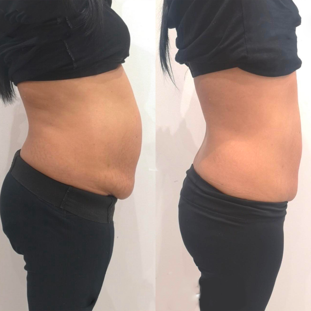 Kivalia Before and After Transformation 1