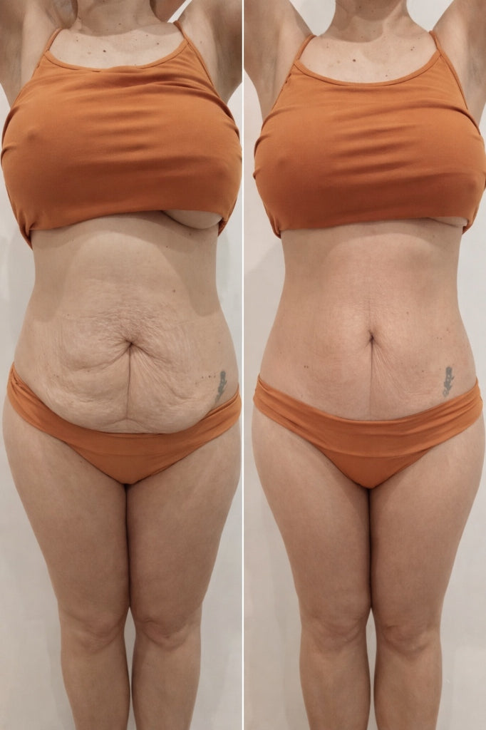 Kivalia Before and After Transformation 3