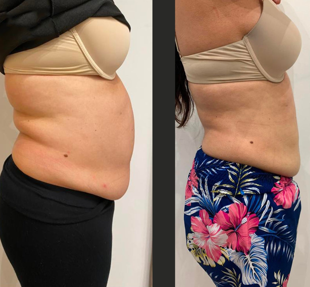 Kivalia Before and After Transformation 4
