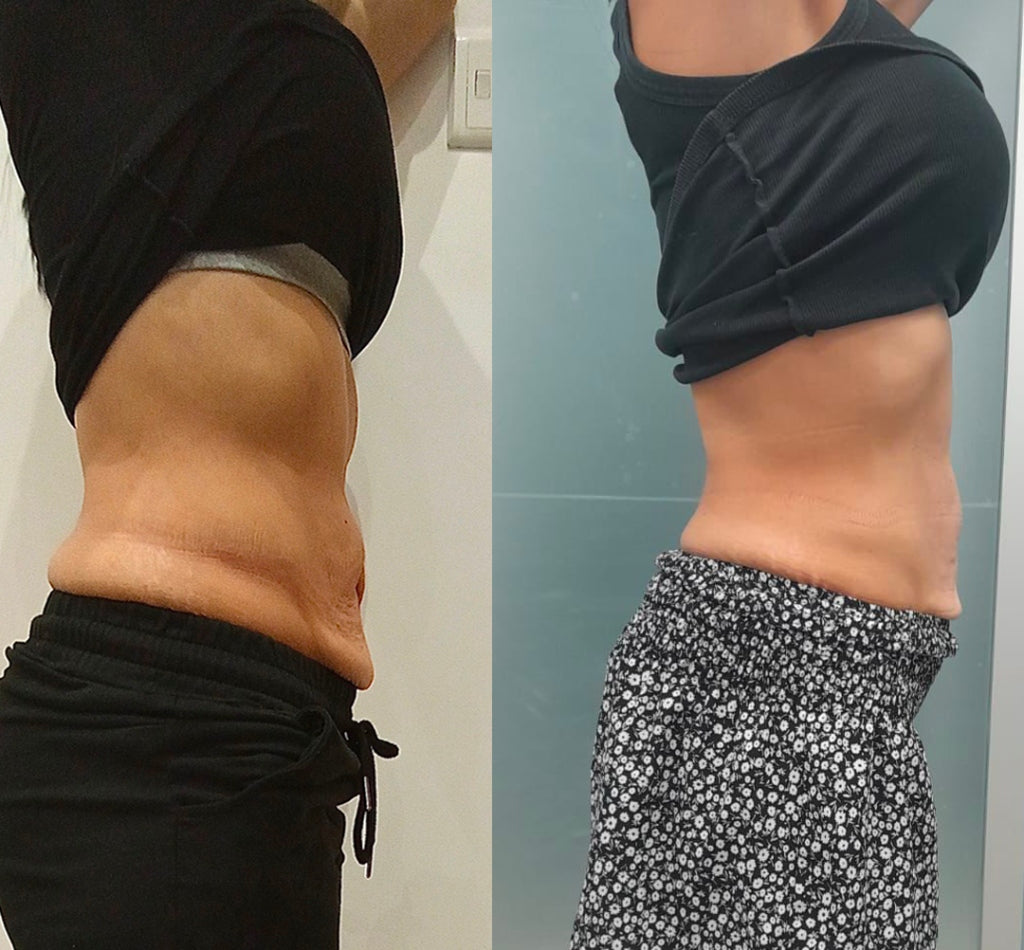 Kivalia Before and After Transformation 5
