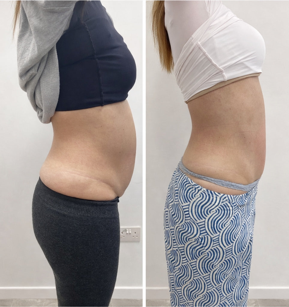 Kivalia Before and After Transformation 6