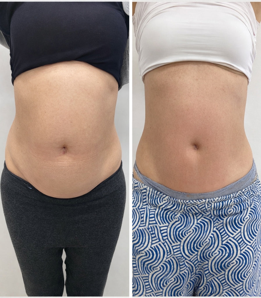 Kivalia Before and After Transformation 8